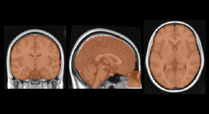 ../../../_images/da03227203af50d4b514b190475ff397fbba95a3a10283e3d823c8306c21e8aa.png